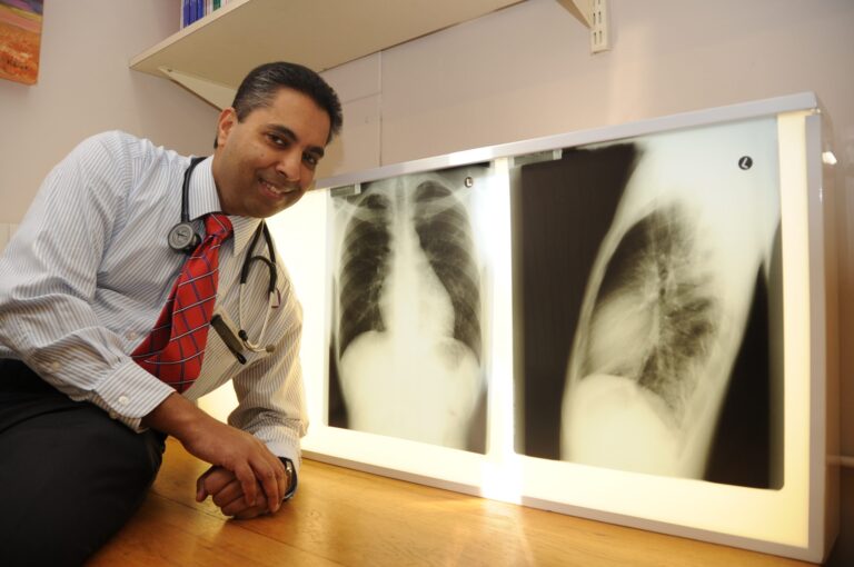 Profile: Keertan Dheda – reflections on a career finding ways to fight TB • Spotlight