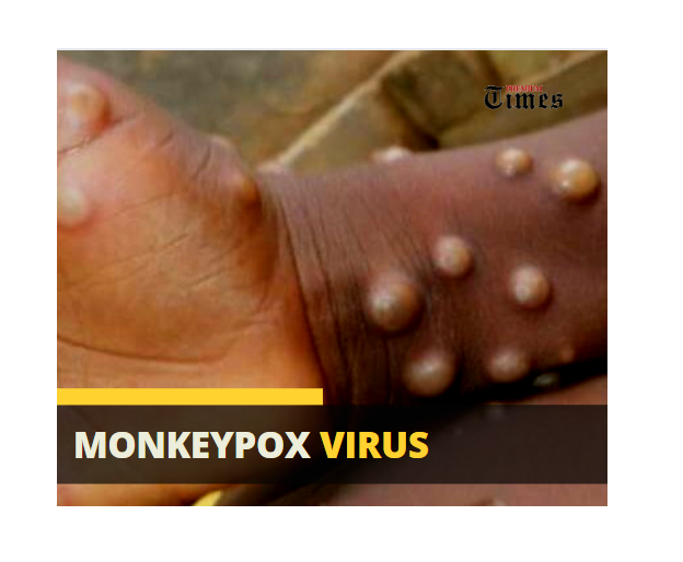 Monkeypox: Borno confirms four infections, as Nigeria’s cases surpass 100 in 2022